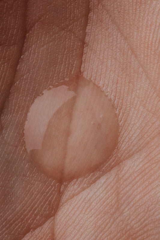 Oily and Dehydrated at the Same Time